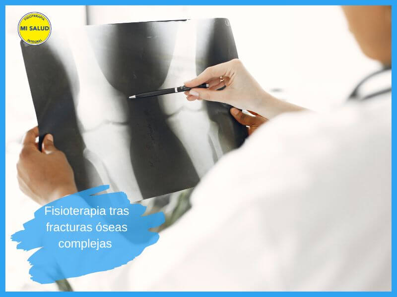 Fisioterapia tras fracturas óseas complejas